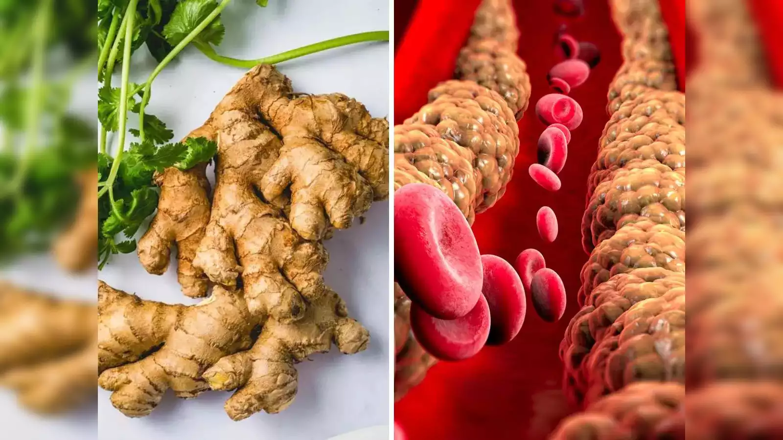 Ginger In Bad Cholesterol: दो तरीकों से अदरक का उपयोग करने से खराब कोलेस्ट्रॉल और ट्राइग्लिसराइड्स कम होने लगेगा 