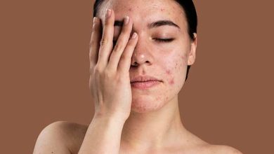 Skin Health: स्ट्रेस चेहरे का निखार छीन सकता है! दाग-धब्बे और पिंपल्स का जोखिम बढ़ाता हैं, वक्त रहते हुए सावधान रहें