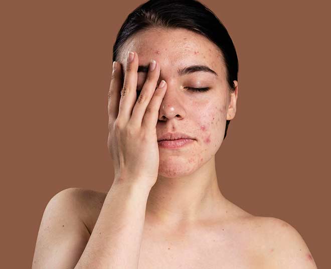 Skin Health: स्ट्रेस चेहरे का निखार छीन सकता है! दाग-धब्बे और पिंपल्स का जोखिम बढ़ाता हैं, वक्त रहते हुए सावधान रहें