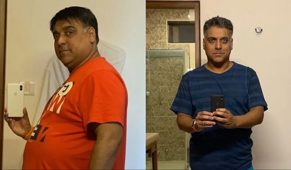 Ram Kapoor Transformation: क्या राम कपूर ने 55 किलो वजन कम करने के लिए करवाई सर्जरी की? बड़े अच्छे लगते हैं फेम एक्टर ने रोमांचक घोषणा की