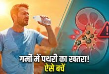 गर्मी में बढ़ा किडनी स्टोन का खतरा, डिहाइड्रेशन बन रहा बड़ा कारण