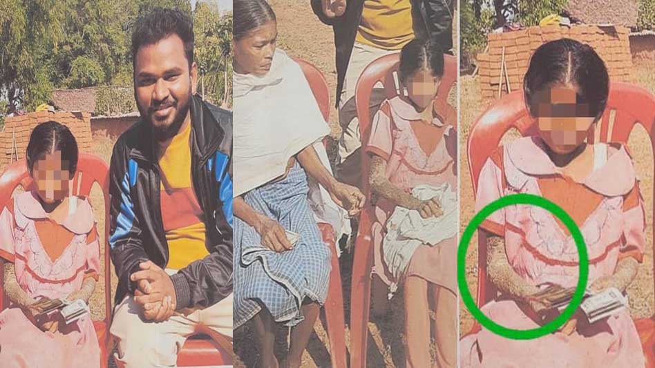 पत्थर जैसी बन रही बच्ची का होगा इलाज, बाल आयोग ने मामले में दिखाई सक्रियता पत्थर जैसी बन रही बच्ची का होगा इलाज, बाल आयोग ने मामले में दिखाई सक्रियता