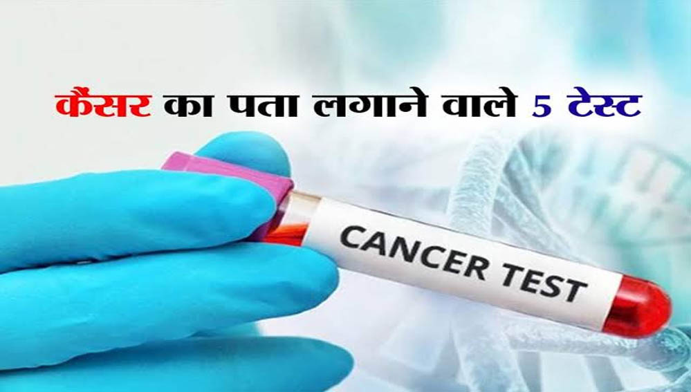 चौंकाने वाली रिपोर्ट: भारत में हर 10वां व्यक्ति कैंसर के खतरे में, 15 में से 1 मरीज की मौत की आशंका
