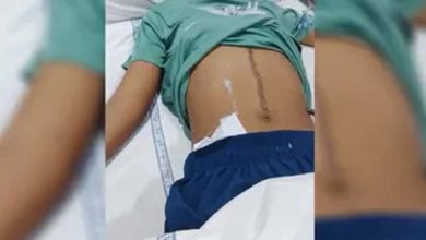 स्कूल में मामूली विवाद ने लिया हिंसक रूप, छात्र ने कुर्सी से किया हमला; 22 टांके लगे स्कूल में मामूली विवाद ने लिया हिंसक रूप, छात्र ने कुर्सी से किया हमला; 22 टांके लगे