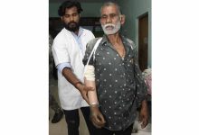 ट्रेन हादसे के दर्द पर 'सेवा संकल्प' का मरहम, धमतरी के तेजराम को दो घंटे में मिला कृत्रिम हाथ, लौटी जिंदगी की रंगत